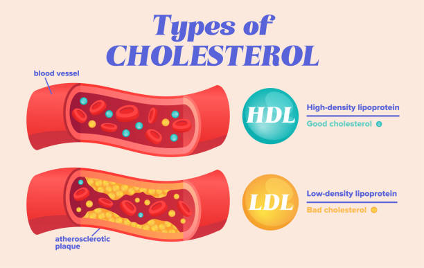 How to lower cholesterol naturally
